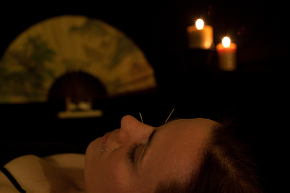 Acupuncture by Candlelight Shot by Scottsdale Photographer Craig Amrine
