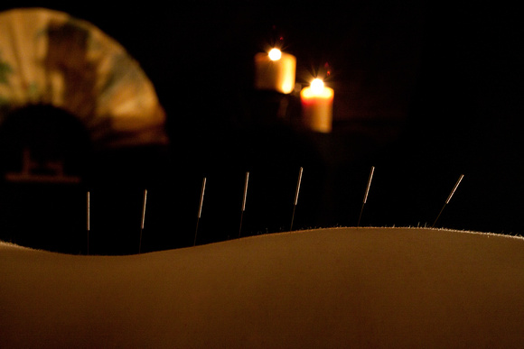 Acupuncture by Candlelight Shot by Scottsdale Photographer Craig Amrine
